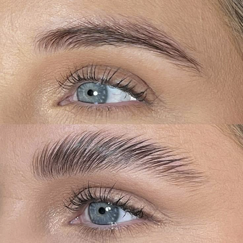 لیفت ابرو با مواد حرفه‌ای | راهنمای کامل، مزایا، معایب و مراقبت‌ها