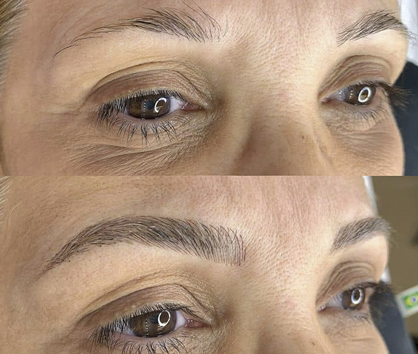 میکروپیگمنتیشن چقدر ایمن است؟ باورهای غلطی که باید کنار بگذارید