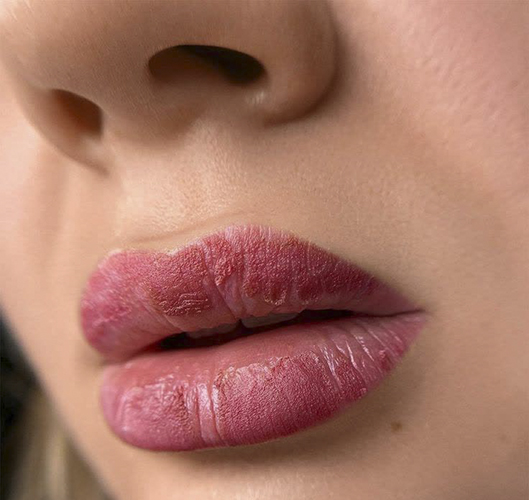 مراقبت‌های قبل و بعد از شیدینگ لب برای جلوگیری از تغییر رنگ ناخواسته