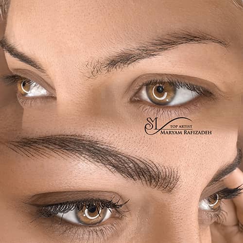 هیراستروک - کد ۱۰۶