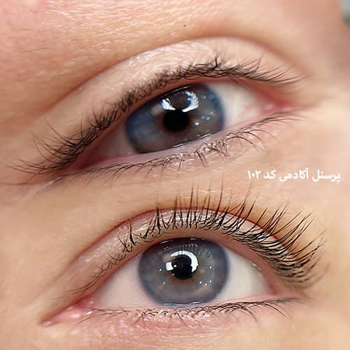 لیفت مژه ۱۰۲