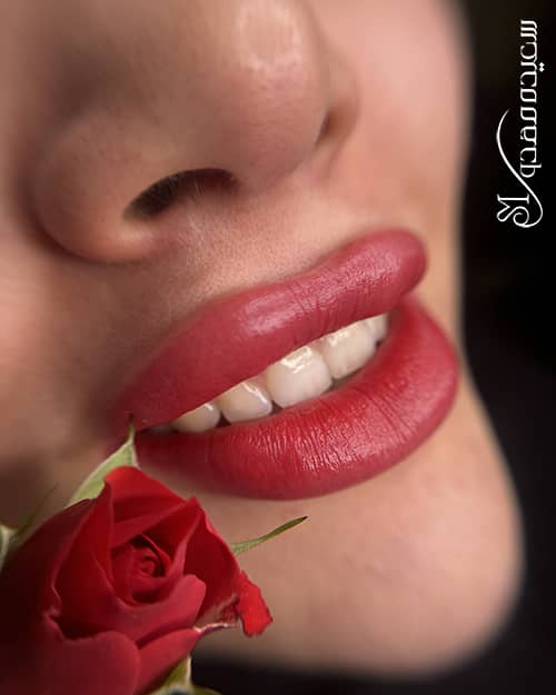 فول شیدینگ - ۱۰۰