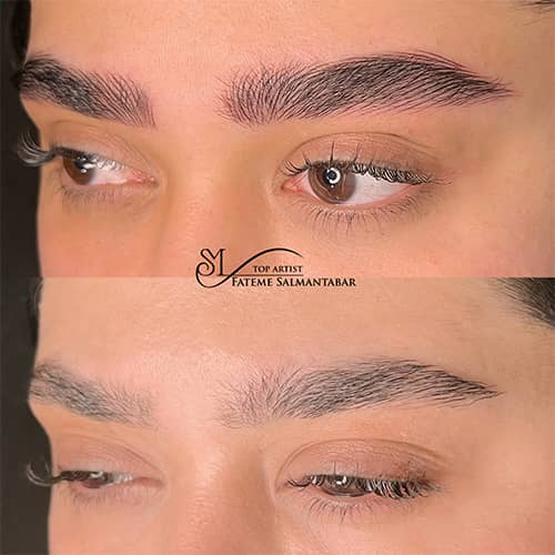 هیراستروک - کد ۱۰۷