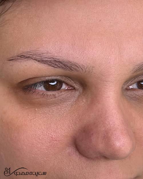 هیراستروک ابرو