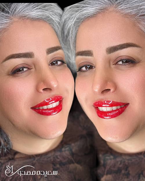 فول شیدینگ - ۱۰۳