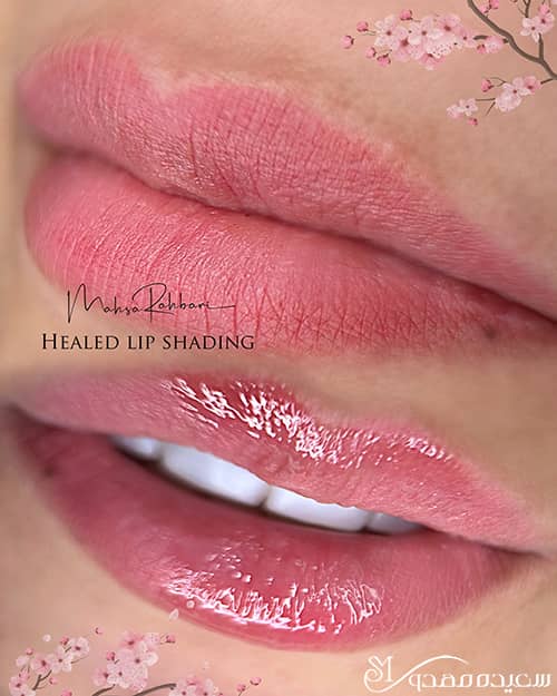 هیلد لیپ شیدینگ- ۱۰۳