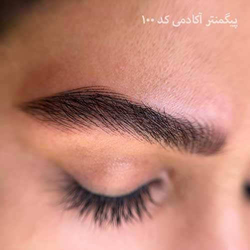 هیراستروک ۱۰۰