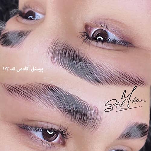 لیفت ابرو ۱۰۲