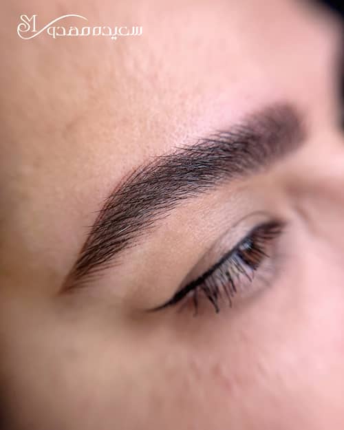 هیر استروک - ۱۰۳