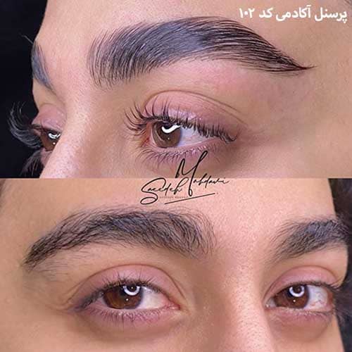 لیفت ابرو ۱۰۲