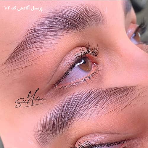 لیفت ابرو ۱۰۲